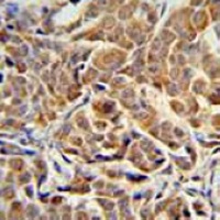 ALDH3A2 Mouse Monoclonal Antibody