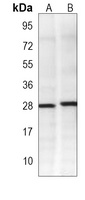 BAP31 Mouse Monoclonal Antibody