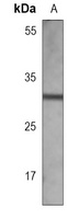 PPT Mouse Monoclonal Antibody