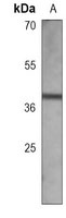 RASSF2 Mouse Monoclonal Antibody