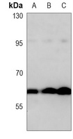 MMP14 Mouse Monoclonal Antibody