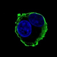 MMP14 Mouse Monoclonal Antibody