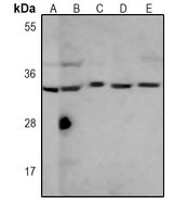 SULT1A1 Mouse Monoclonal Antibody