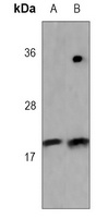 FHIT Mouse Monoclonal Antibody