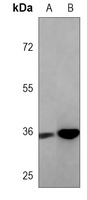 SOX2 Mouse Monoclonal Antibody