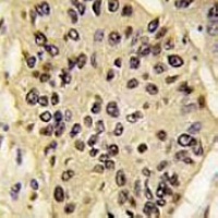 SOX2 Mouse Monoclonal Antibody