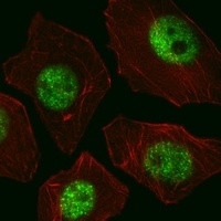 SOX2 Mouse Monoclonal Antibody