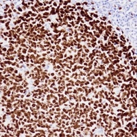 Ki67 Antibody