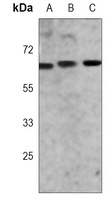 ZAP70 Mouse Monoclonal Antibody