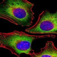 ZAP70 Mouse Monoclonal Antibody