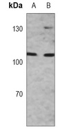MSH2 Antibody [KO/KD Validated]