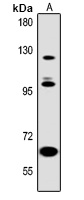 ABL2 Mouse Monoclonal Antibody