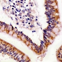 ABL2 Mouse Monoclonal Antibody