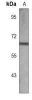 ACVR1B Mouse Monoclonal Antibody