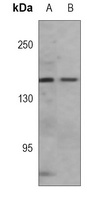 VEGFR3 Mouse Monoclonal Antibody