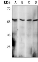 AKT2 Mouse Monoclonal Antibody