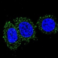 AKT2 Mouse Monoclonal Antibody