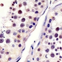 CDC25C Mouse Monoclonal Antibody