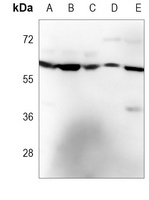 PPP2R1B Mouse Monoclonal Antibody