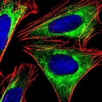 PPP2R1B Mouse Monoclonal Antibody