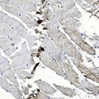 EPHB2 Mouse Monoclonal Antibody