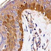 S100-A2 Mouse Monoclonal Antibody