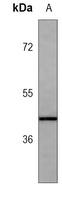 LOX Mouse Monoclonal Antibody