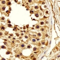 PSMA5 Mouse Monoclonal Antibody