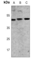 GATA3 Mouse Monoclonal Antibody