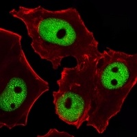 GATA3 Mouse Monoclonal Antibody