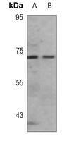 Acetylcholinesterase Mouse Monoclonal Antibody