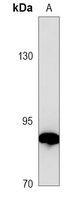 Transglutaminase 2 Mouse Monoclonal Antibody