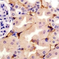 CD73 Mouse Monoclonal Antibody