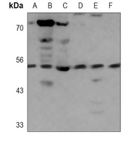H1L Antibody