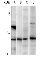 RAB3B Mouse Monoclonal Antibody