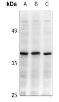 TBP Mouse Monoclonal Antibody