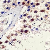 TBP Mouse Monoclonal Antibody