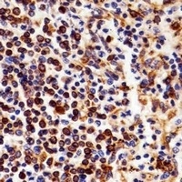NF-kappaB p105 Mouse Monoclonal Antibody