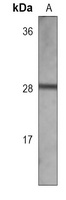 Galectin 3 Mouse Monoclonal Antibody