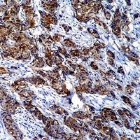 Galectin 3 Mouse Monoclonal Antibody