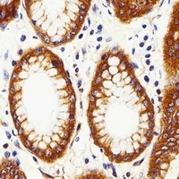 Calpain 2 Mouse Monoclonal Antibody