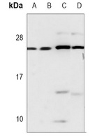 MGMT Mouse Monoclonal Antibody