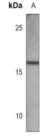 nm23-H1 Mouse Monoclonal Antibody