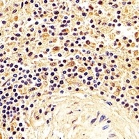 nm23-H1 Mouse Monoclonal Antibody