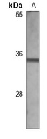 MYOD1 Mouse Monoclonal Antibody