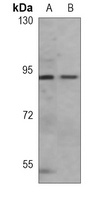 B-RAF Mouse Monoclonal Antibody