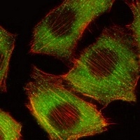 B-RAF Mouse Monoclonal Antibody