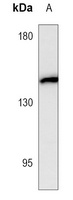 CD143 Mouse Monoclonal Antibody