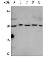 PCNA Antibody [KO/KD Validated]