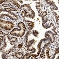PCNA Antibody [KO/KD Validated]